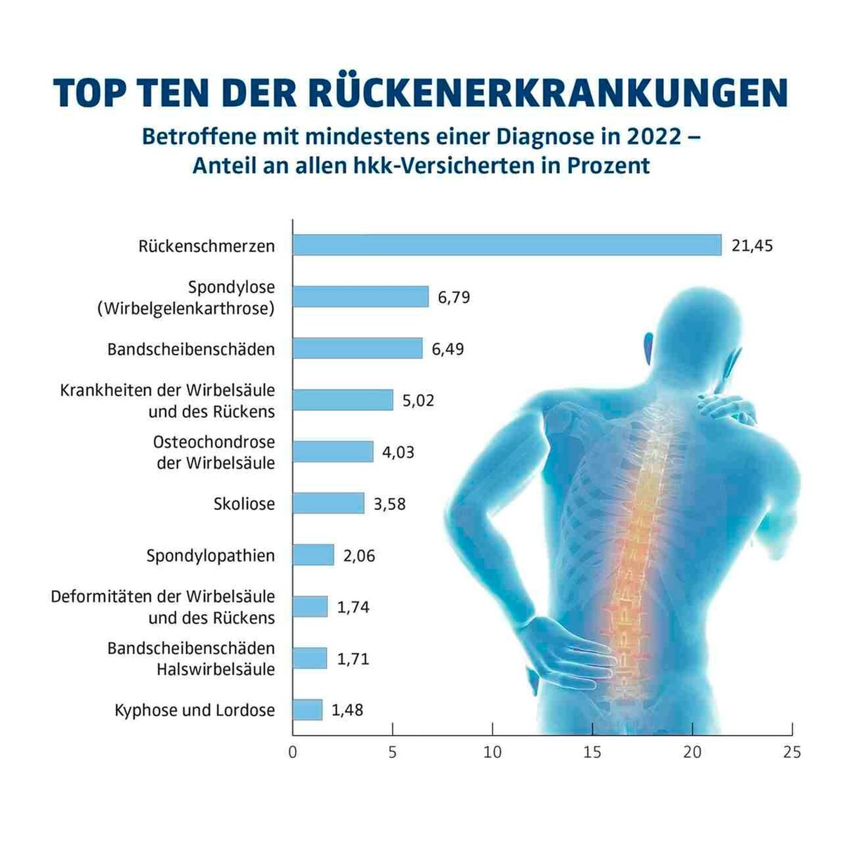 hkk-Datenanalyse:Jeder Dritte leidet unter Rückenbeschwerden