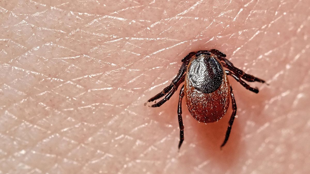 Treating and billing for tick bites